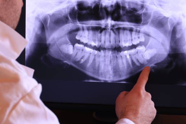 Best Orthodontic Emergency Dentist in Church Hill, MD